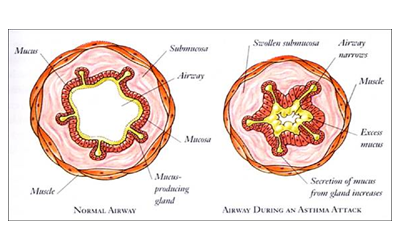 pathogenesis1